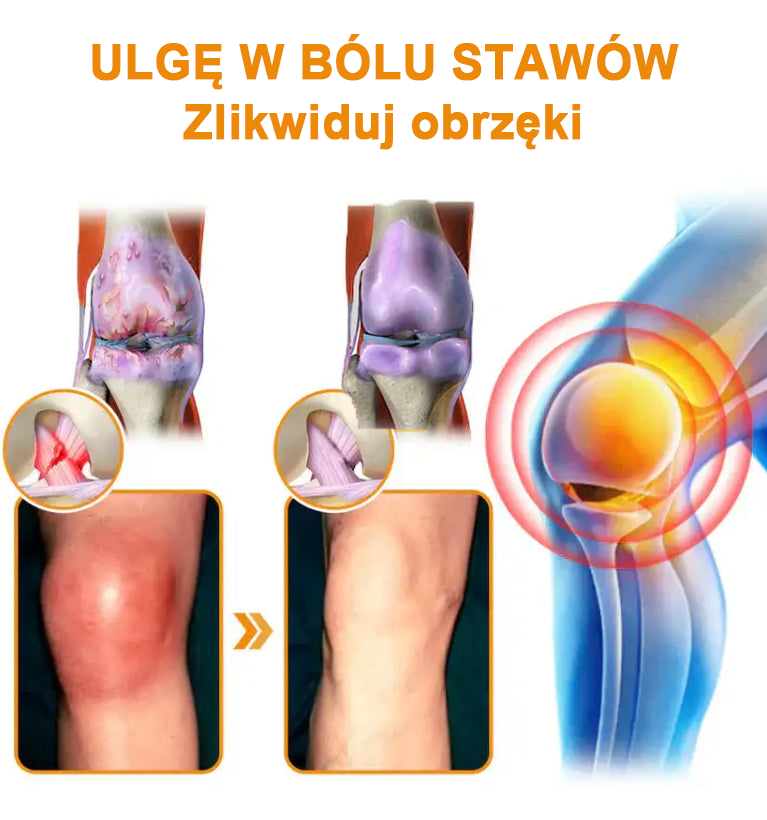✅Oficjalny sklep: Ouryard™ Olej magnezowy i miód w sprayu do naprawy stawów👨⚕️Zatwierdzony przez Polską Agencję Leków, Wyrobów Medycznych i Produktów Biologicznych (URPL)🔥🔥