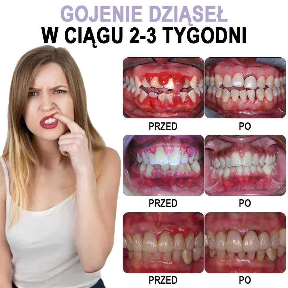 ✅Oficjalny sklep | Spray do pielęgnacji jamy ustnej Instant Smile™ Clove Oil 🧑🏼⚕️ Certyfikowany przez Niemieckie Stowarzyszenie Stomatologiczne 🍀