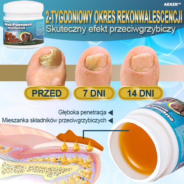 ✨Aexzr™ 5X Szybko leczący grzybicę paznokci Ointment👨🏼⚕️British Zatwierdzony przez dermatologa