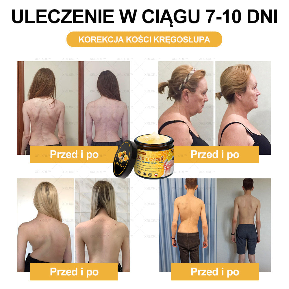 ✨✨XRLXRL™ Krem Łagodzący Ból i Leczenie Kości z Jadłem Pszczelim (Specjalnie dla starszych dorosłych i polecany przez AAOS)