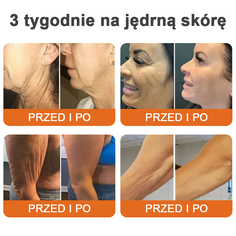 🌴🎁Wyprodukowane i wysłane z Australii - Flysmus® AH-8 Krem do napięcia i liftingu szyi - OSTATNI DZIEŃ 70% ZNIŻKI