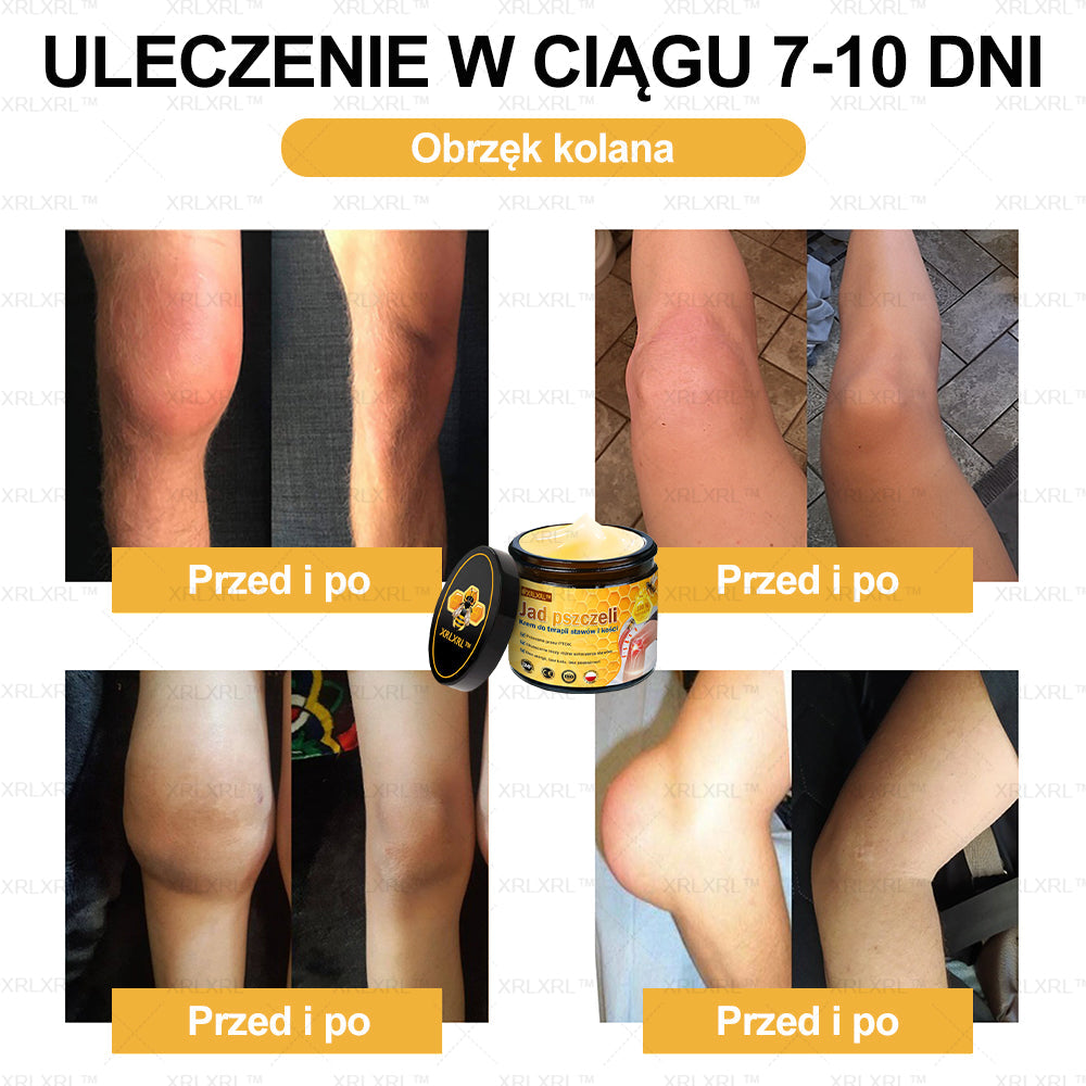 ✨✨XRLXRL™ Krem Łagodzący Ból i Leczenie Kości z Jadłem Pszczelim (Specjalnie dla starszych dorosłych i polecany przez AAOS)