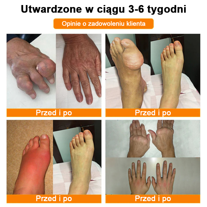 ✅Oficjalny sklep: Ouryard™ Olej magnezowy i miód w sprayu do naprawy stawów👨⚕️Zatwierdzony przez Polską Agencję Leków, Wyrobów Medycznych i Produktów Biologicznych (URPL)🔥🔥