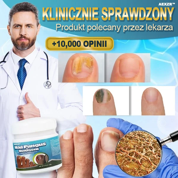 ✨Aexzr™ 5X Szybko leczący grzybicę paznokci Ointment👨🏼⚕️British Zatwierdzony przez dermatologa