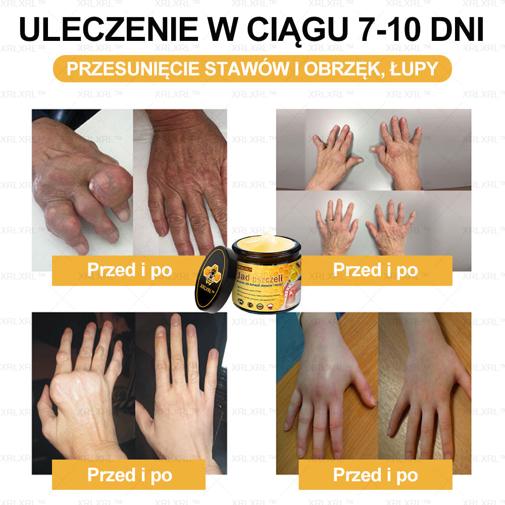 ✨✨XRLXRL™ Krem Łagodzący Ból i Leczenie Kości z Jadłem Pszczelim (Specjalnie dla starszych dorosłych i polecany przez AAOS)