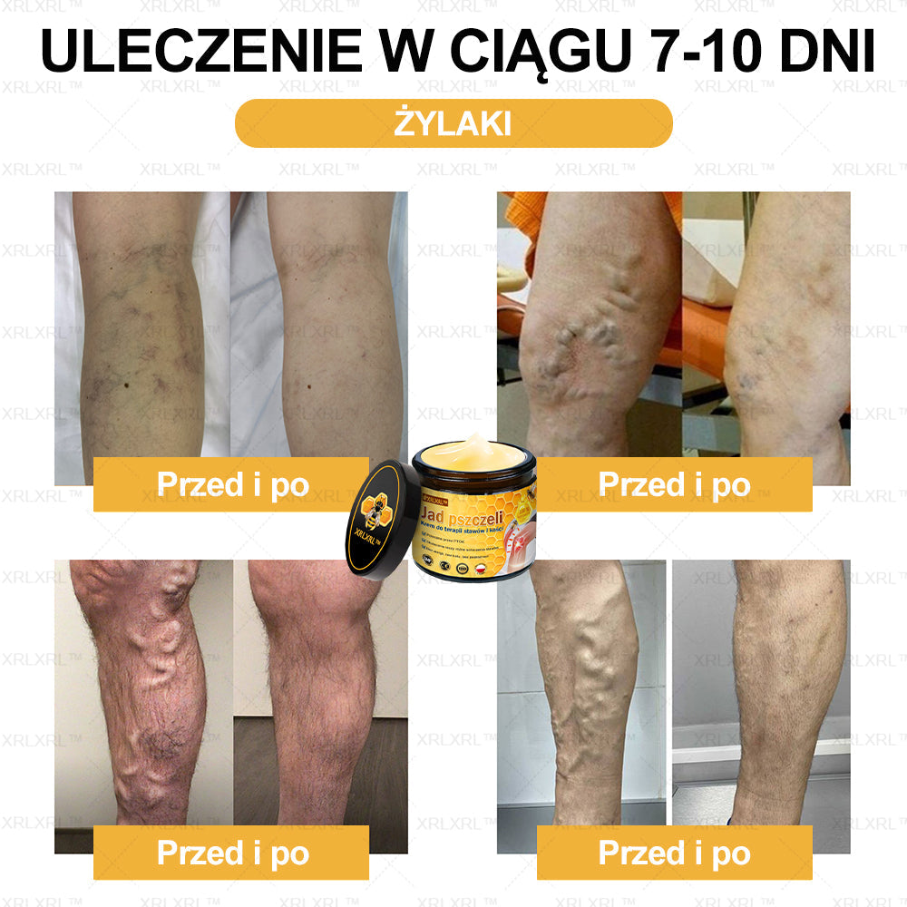 ✨✨XRLXRL™ Krem Łagodzący Ból i Leczenie Kości z Jadłem Pszczelim (Specjalnie dla starszych dorosłych i polecany przez AAOS)