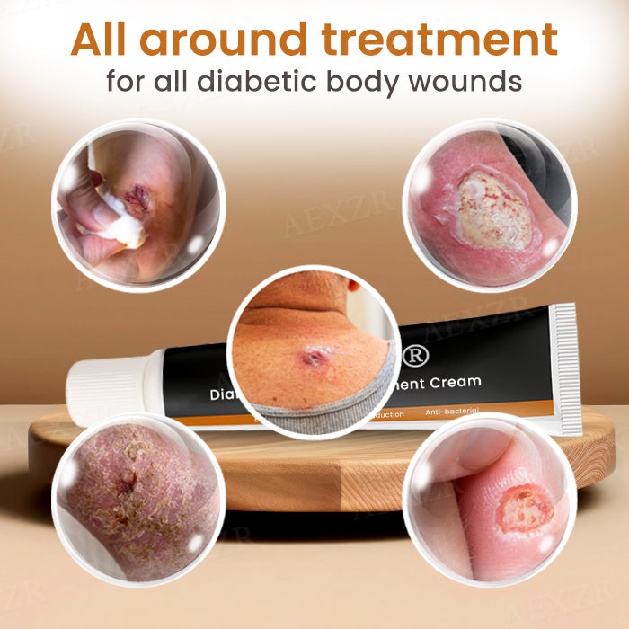 ⏰Ostatnia promocja: 60% zniżki🔥 Krem Cvreoz® Advanced Wound Healing Cream dla skóry cukrzycowej