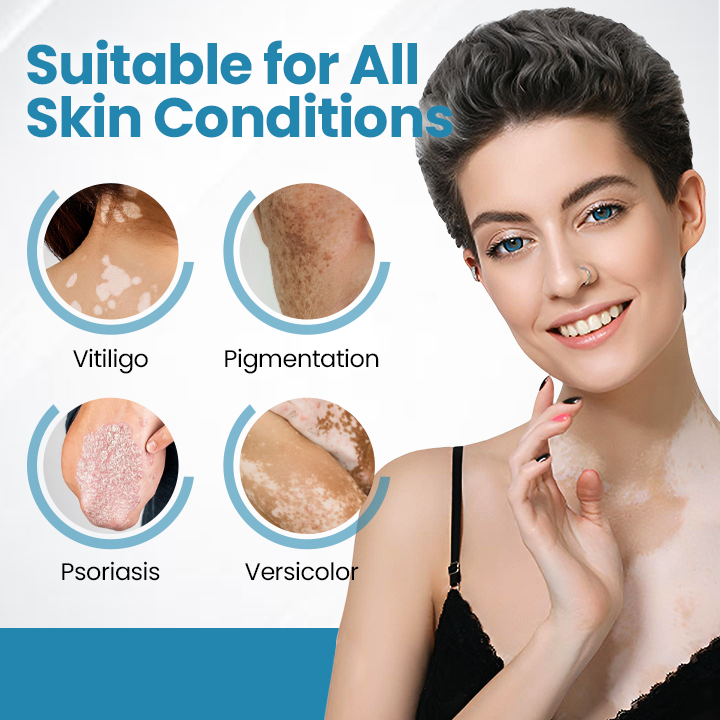 Bikenda® DermaBeam – Urządzenie do Terapii Bielactwa