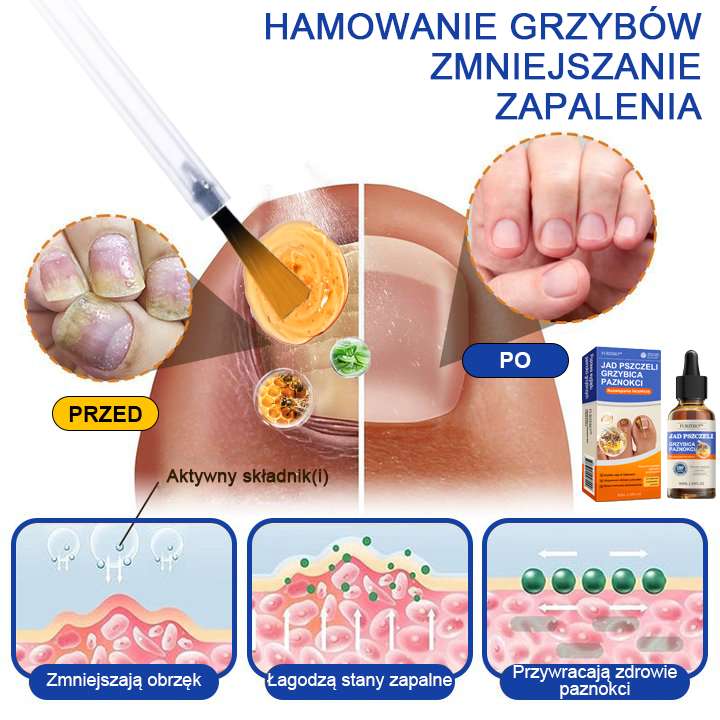 🐝🐝Furzero™ Bienengift Nagelpilz Leczenie: Całkowite rozwiązanie problemu grzybicy paznokci🌟👣