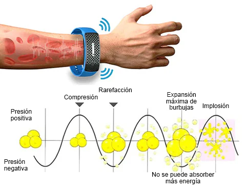 👨‍⚕️💉 𝐉𝐎𝐒𝐅𝑰𝐓™ Muñequeras de ultrasonidos para eliminación de grasa y desintoxicación