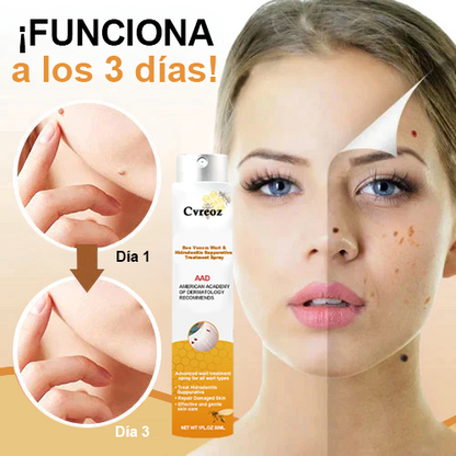 🧡Spray para tratamiento de eliminación de verrugas y etiquetas con veneno de abeja Cvreoz (👨‍⚕AAD RECOMIENDA)🐝🐝(🔥 Promoción del último día con 80 % de descuento)