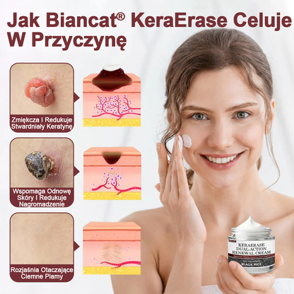 Krem regenerujący Biancat® KeraErase o podwójnym działaniu