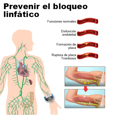 👨‍⚕️💉 𝐉𝐎𝐒𝐅𝑰𝐓™ Muñequeras de ultrasonidos para eliminación de grasa y desintoxicación