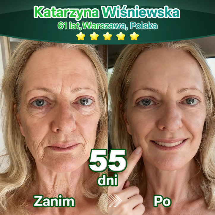 Lotmay® Krople Doustne z Komórkami Macierzystymi i Peptydami Kolagenu 👩‍⚕️ (Ujędrnienie i lifting zwiotczałej skóry • Wspomaga redukcję zmarszczek) 🍀