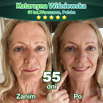 Lotmay® Krople Doustne z Komórkami Macierzystymi i Peptydami Kolagenu 👩‍⚕️ (Ujędrnienie i lifting zwiotczałej skóry • Wspomaga redukcję zmarszczek) 🍀