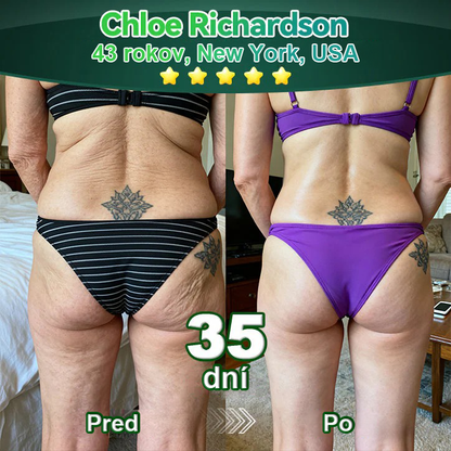 Lotmay® 🚀 Ústne kvapky s kmeňovými bunkami a kolagénovými peptídmi (Vyprúžte a spevnite pokožku a znížte tvorbu vrások)