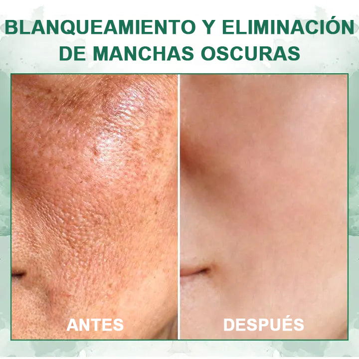 🌿Refresca tu piel en solo tres días💝𝐅𝐮𝐛𝐬𝐭𝐚™ Serum Rejuvenecedor y Reafirmante🔥