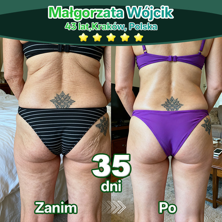 Lotmay® Krople Doustne z Komórkami Macierzystymi i Peptydami Kolagenu 👩‍⚕️ (Ujędrnienie i lifting zwiotczałej skóry • Wspomaga redukcję zmarszczek) 🍀