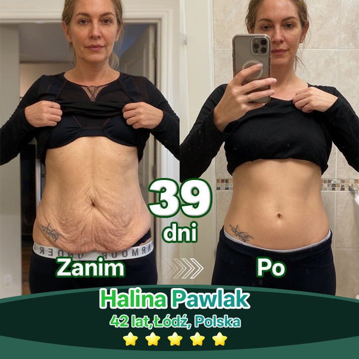 Lotmay® Krople Doustne z Komórkami Macierzystymi i Peptydami Kolagenu 👩‍⚕️ (Ujędrnienie i lifting zwiotczałej skóry • Wspomaga redukcję zmarszczek) 🍀