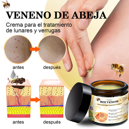 🌿🌿👻𝑻𝒖𝒓𝒐𝒏𝒖™ crema de tratamiento con veneno de abeja [🌿Recomendada por expertos de la piel].