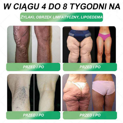 Zalecane przez Centrum Zdrowia w Polsce | Oficjalny sklep 👨‍⚕️👨‍⚕️HHVB® GLP-1 doustny roztwór na odchudzanie 💥 Otyłość, choroby układu krążenia, cukrzyca, bezdech senny, problemy ze stawami i inne