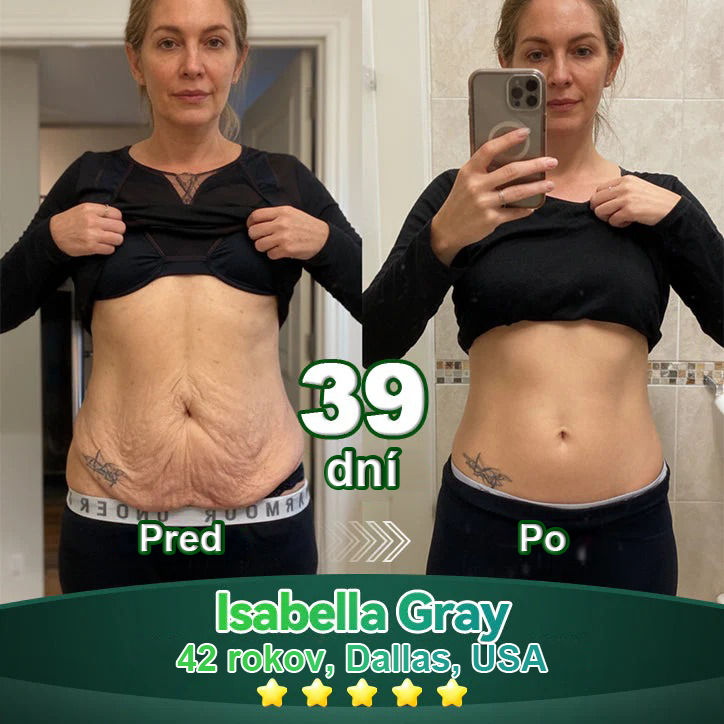 Lotmay® 🚀 Ústne kvapky s kmeňovými bunkami a kolagénovými peptídmi (Vyprúžte a spevnite pokožku a znížte tvorbu vrások)