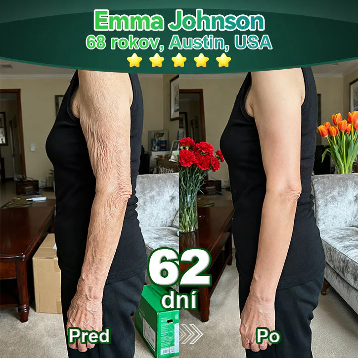 Lotmay® 🚀 Ústne kvapky s kmeňovými bunkami a kolagénovými peptídmi (Vyprúžte a spevnite pokožku a znížte tvorbu vrások)