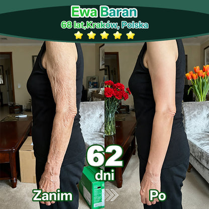 Lotmay® Krople Doustne z Komórkami Macierzystymi i Peptydami Kolagenu 👩‍⚕️ (Ujędrnienie i lifting zwiotczałej skóry • Wspomaga redukcję zmarszczek) 🍀