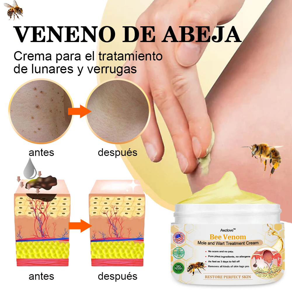 🌟[🌟Tienda de marca oficial🌟] 𝐀𝐰𝐳𝐥𝐨𝐯𝐞™ Crema para el tratamiento de verrugas y lunares con veneno de abeja (👨‍⚕AAD RECOMIENDA)