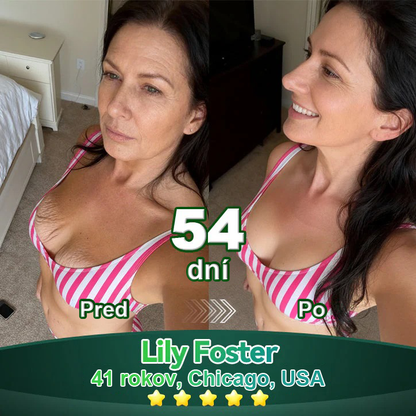 Lotmay® 🚀 Ústne kvapky s kmeňovými bunkami a kolagénovými peptídmi (Vyprúžte a spevnite pokožku a znížte tvorbu vrások)