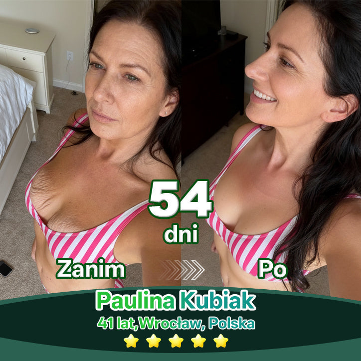 Lotmay® Krople Doustne z Komórkami Macierzystymi i Peptydami Kolagenu 👩‍⚕️ (Ujędrnienie i lifting zwiotczałej skóry • Wspomaga redukcję zmarszczek) 🍀