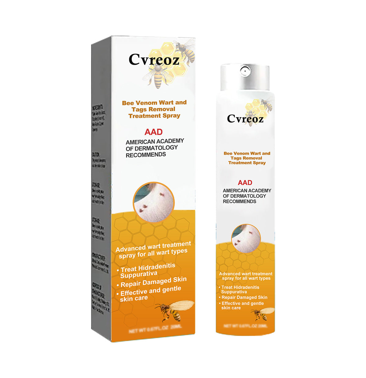 🧡Spray para tratamiento de eliminación de verrugas y etiquetas con veneno de abeja Cvreoz (👨‍⚕AAD RECOMIENDA)🐝🐝(🔥 Promoción del último día con 80 % de descuento)